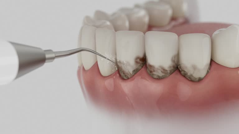 Trusted Dental Implants service in Fox River Grove, IL - Dentist Open Now